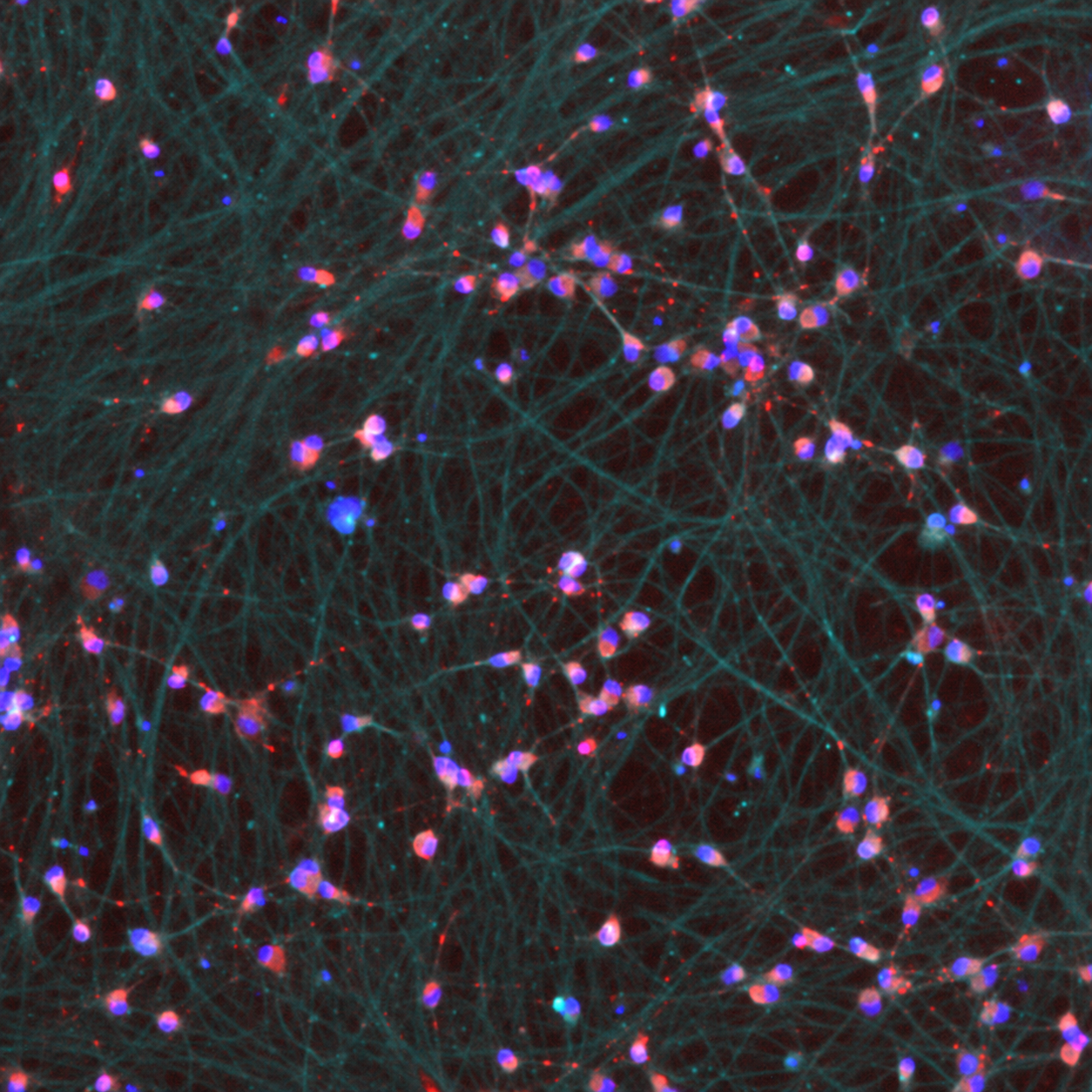 West Nile virus infected iPSC-derived neurons publication image